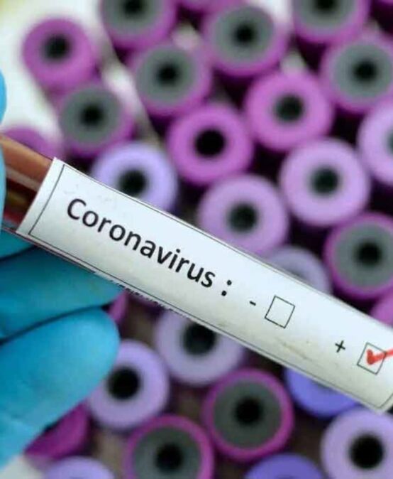 Посебне мере због коронавируса